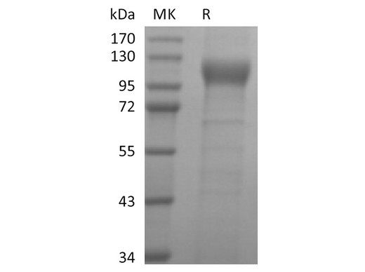 Recombinant Human ACE2 Protein (Avi-His Tag) - ABMIUM