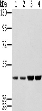 Anti-Human SSB Antibody - ABMIUM