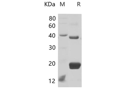 SDS-PAGE analysis of Mouse TIMP1 proteins, 2 μg/lane of Recombinant Mouse TIMP1 proteins was resolved with SDS-PAGE under reducing conditions, showing bands at 22.18 kDa.