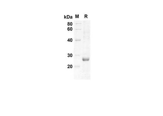 SDS-PAGE analysis of Mouse LIX proteins, 2 μg/lane of Recombinant Mouse LIX proteins was resolved with an SDS-PAGE under reducing conditions, showing bands at 21 kDa.