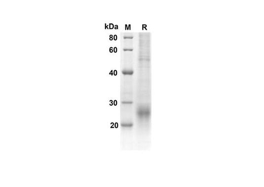 SDS-PAGE analysis of Human ACVRL1 proteins, 2 μg/lane of Recombinant Human ACVRL1 proteins was resolved with an SDS-PAGE under reducing conditions, showing bands at 10.5 kDa.