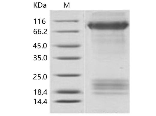 Recombinant EBOV (subtype Zaire, strain Mayinga 1976) Glycoprotein / GP Protein (His Tag) - ABMIUM
