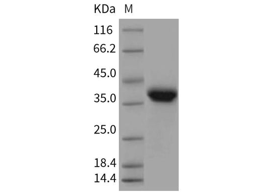 > 97 % as determined by reducing SDS-PAGE.