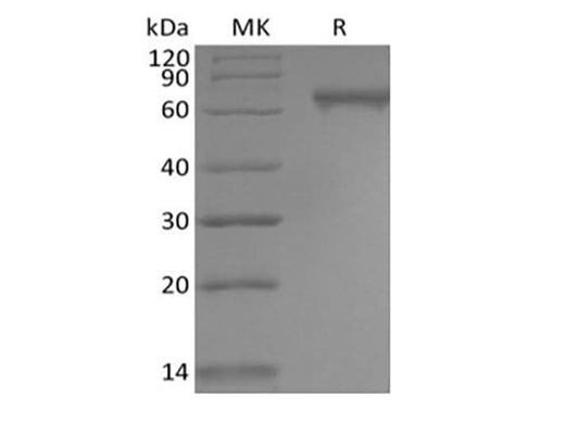Recombinant Human Notch2 (C-6His) - ABMIUM