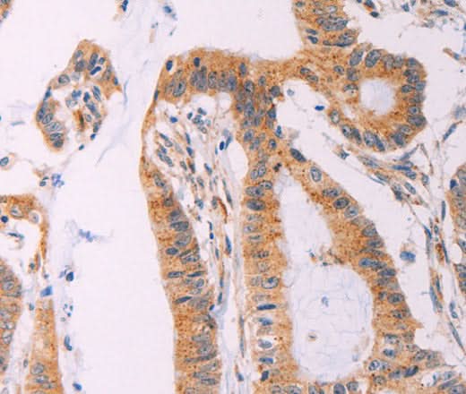 Anti-Human ADCY1 Antibody - ABMIUM