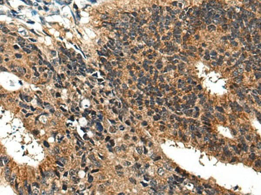 Anti-Human/Mouse BMPER Antibody