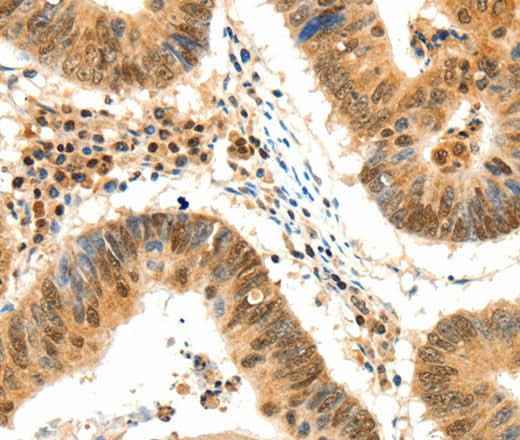Anti-Human TERF2 Antibody - ABMIUM