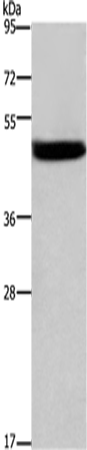 Anti-Human/Mouse/Rat CTSE Antibody - ABMIUM