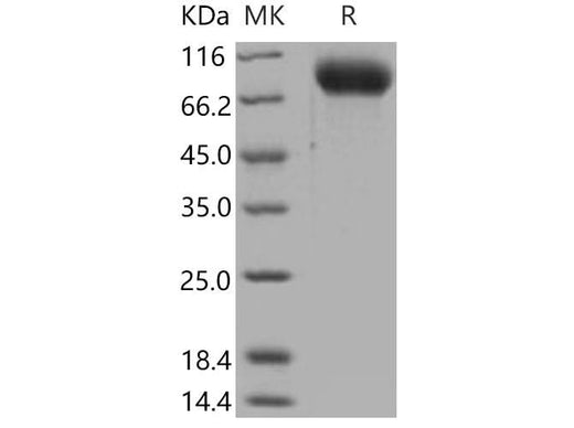 Recombinant Mouse ICAM-1/CD54 Protein (His Tag) - ABMIUM
