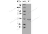 Recombinant Human TNFSF14/LIGHT Protein (His Tag) - ABMIUM