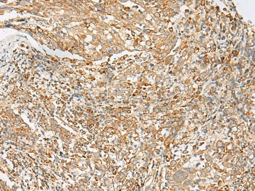 Anti-Human/Mouse MBOAT4 Antibody - ABMIUM