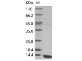 Recombinant WNV (lineage 2, strain Nea Santa-Greece-2010) E / Envelope Protein (Domain III, His Tag) - ABMIUM