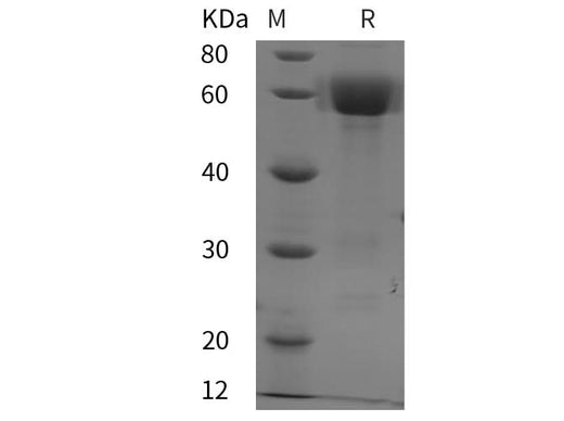 SDS-PAGE analysis of Mouse DKK3 proteins, 2 μg/lane of Recombinant Mouse DKK3 proteins was resolved with SDS-PAGE under reducing conditions, showing bands at 60 kDa.