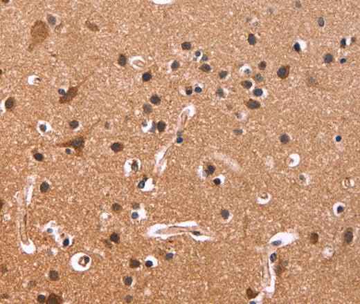 Anti-Human/Mouse/Rat CSNK1D Antibody