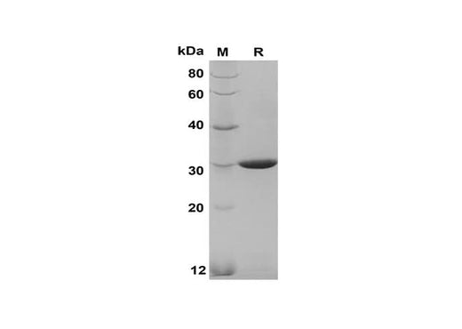 SDS-PAGE analysis of Mouse NT-PROBNP proteins, 2 μg/lane of Recombinant Mouse NT-PROBNP proteins was resolved with SDS-PAGE under reducing conditions, showing bands at 30 kDa.