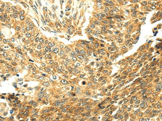 Anti-Human SERPINA12 Antibody - ABMIUM