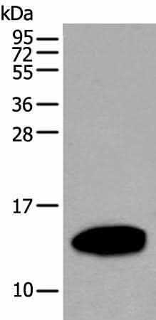 Western blot analysis of Human pancreas tissue lysate using REG1A Polyclonal Antibody at dilution of 1:500
