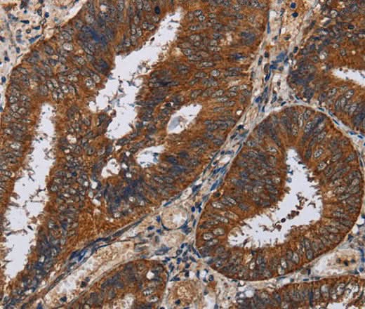 Anti-Human KLK11 Antibody - ABMIUM