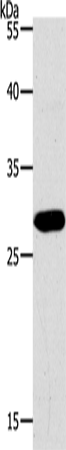 Anti-Human/Mouse PAX5 Antibody - ABMIUM