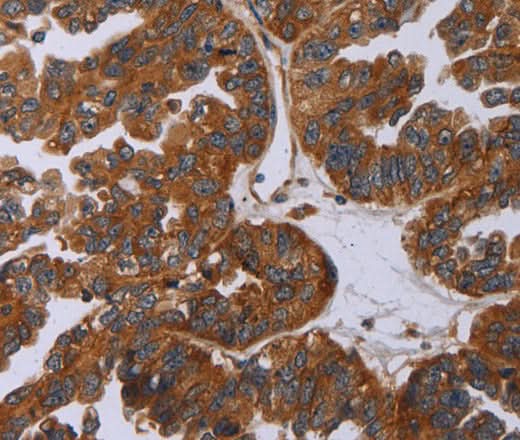 Anti-Human/Mouse/Rat P2RY2 Antibody - ABMIUM