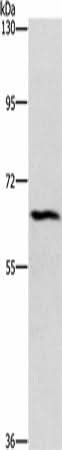 Anti-Human CERKL Antibody - ABMIUM