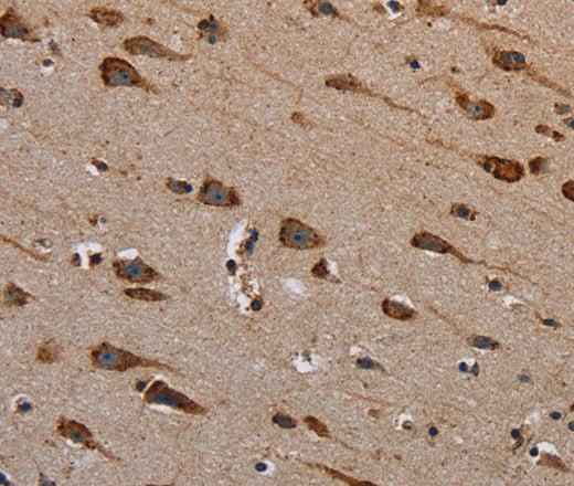 Anti-Human/Mouse PLXNB1 Antibody
