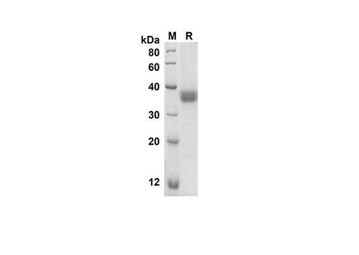 SDS-PAGE analysis of Human CD274 proteins, 2 μg/lane of Recombinant Human CD274 proteins was resolved with an SDS-PAGE under reducing conditions, showing bands at 26.1 kDa.