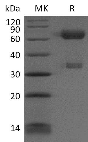 Recombinant Cynomolgus PD-1/CD279/PDCD1 Protein (Fc Tag) - ABMIUM