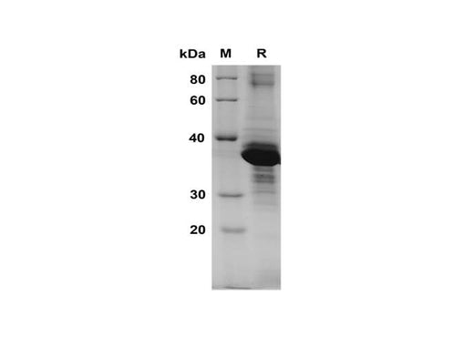 SDS-PAGE analysis of Human Rad51 proteins, 2 μg/lane of Recombinant Human Rad51 proteins was resolved with SDS-PAGE under reducing conditions, showing bands at 37 kDa.