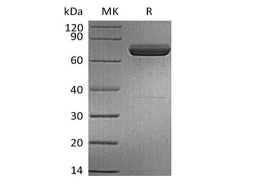 Recombinant Human IL-23 alpha & Mouse IL-12 beta Heterodimer (C-6His) - ABMIUM