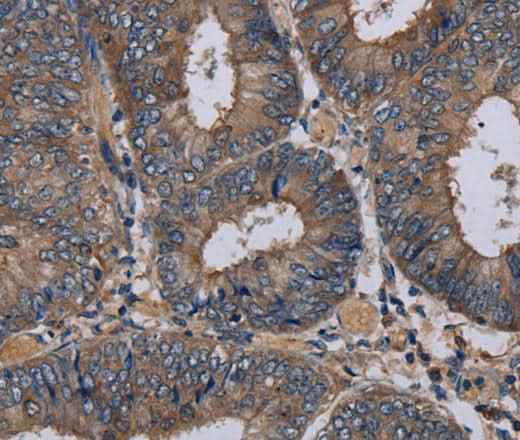 Anti-Human/Mouse NECTIN3 Antibody