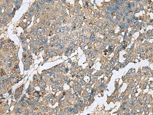Anti-Human PLA2G2A Antibody