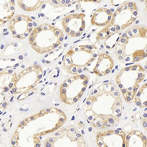 Immunohistochemistry analysis of paraffin-embedded human kidney using PMVK Polyclonal Antibody at dilution of 1:1000.