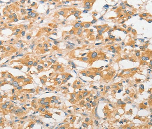 Anti-Human TLR5 Antibody - ABMIUM