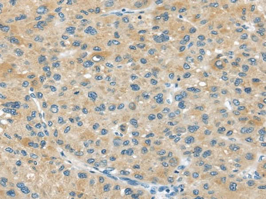 Anti-Human ABCC2 Antibody - ABMIUM