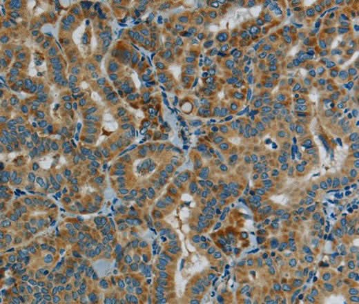 Anti-Human PPARGC1B Antibody - ABMIUM