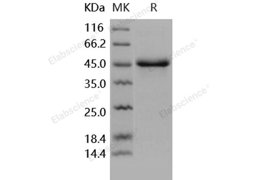 Recombinant Human SerpinE1/PAI-1 Protein (His Tag) - ABMIUM