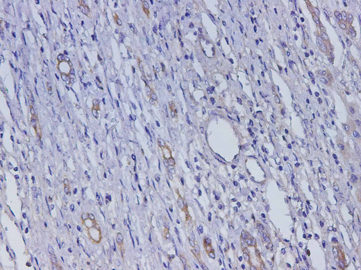 Anti-Human AFP Antibody - ABMIUM