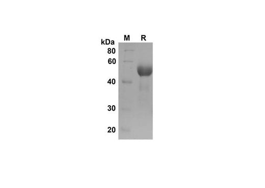 SDS-PAGE analysis of Human Fcγ RIIB/CD32b proteins , 2 μg/lane of Recombinant HumanFcγ RIIB/CD32b proteins was resolved with SDS-PAGE under reducing conditions , showing bands at 50 kDa.