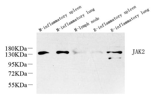 Western Blot analysis of various samples using JAK2 Polyclonal Antibody at dilution of 1:1000.