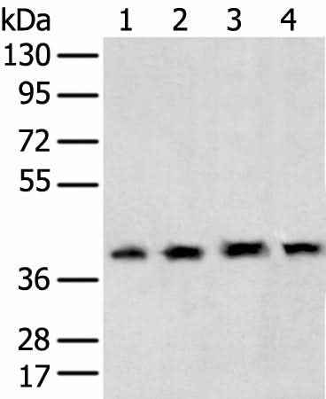 Western blot analysis of 231 cell Human testis tissue Hela and Hepg2 cell using TBP Polyclonal Antibody at dilution of 1:400