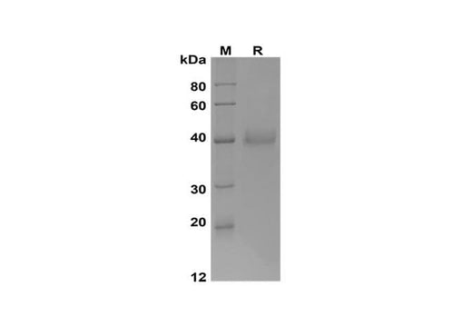 SDS-PAGE analysis of Human Cathepsin B proteins, 2 μg/lane of Recombinant Human Cathepsin B proteins was resolved with SDS-PAGE under reducing conditions, showing bands at 38-42 kDa.