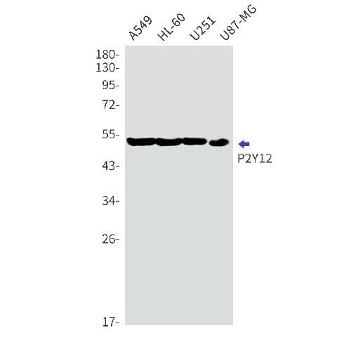 Western blot detection of P2Y12 in A549,HL-60,U251,U87-MG cell lysates using P2Y12 Rabbit mAb(1:1000 diluted).Predicted band size:40kDa.Observed band size:52kDa.
