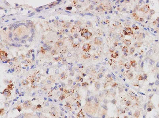 Anti-Human PDGF-AA Antibody - ABMIUM