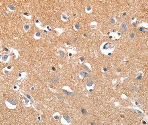 Anti-Human LRP3 Antibody - ABMIUM