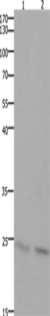 Anti-Human/Mouse HMGB3 Antibody - ABMIUM