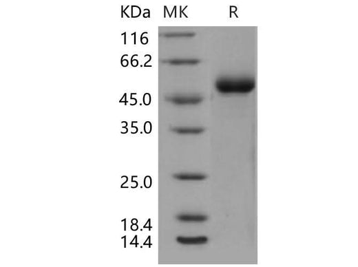 Recombinant Mouse DDR1 Kinase/MCK10 Protein (His Tag) - ABMIUM