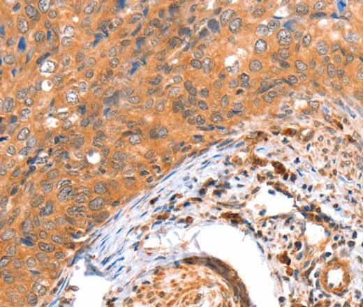 Anti-Human ACOX3 Antibody - ABMIUM