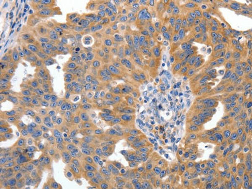 Anti-Human/Mouse IRS2 Antibody - ABMIUM