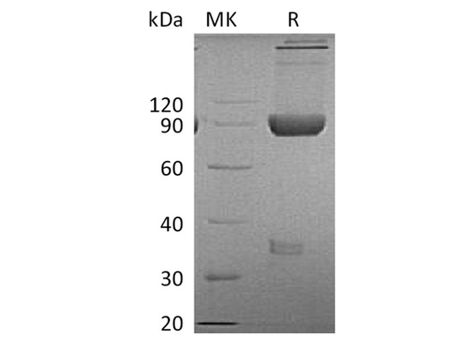 Recombinant Cynomolgus LAG-3/CD223 Protein (Fc Tag) - ABMIUM